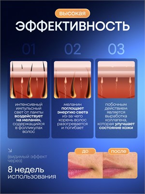 Женский фотоэпилятор предназначен для удаления волос 1000025332