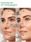Diva - это процедура ультразвуковой чистки лица, предлагаемая компанией ReadySkin. 1000020664