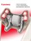 Yamaguchi Qi Massager - отличный подарок для мамы, жены или подруги на день рождения. Этот массажер предназначен для шеи, плеч и поясницы, и поможет им расслабиться и получить удовольствие от массажа 1000037848