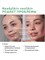 Микротоки для лица Neoskin от ReadySkin. 1000020680