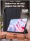 Трехслойный чехол-книжка для планшета Honor Pad X9 2023 (ELN-W09), Honor Pad X8 Pro (11.5") / Honor Pad X9, Honor Pad X8 Pro 1000037045
